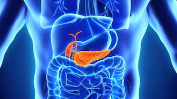 Inflamación de la vesícula: por