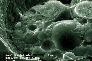 La quitridiomicosis, causada por el