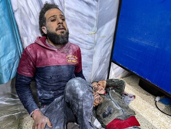 Un niño herido espera tratamiento