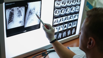 Un doctor observa una radiografía