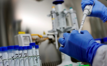 Los casos de reinfección dicen
